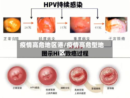 疫情高危地区港/疫情高危型地区