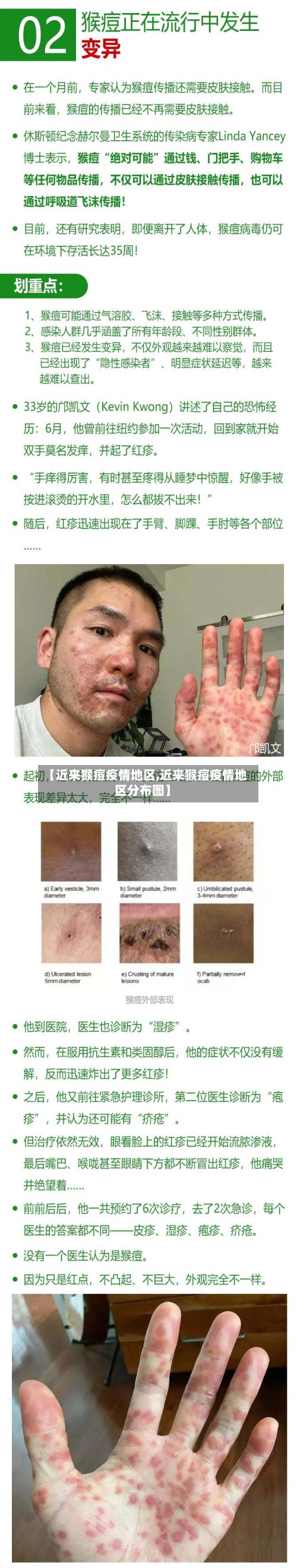 【近来猴痘疫情地区,近来猴痘疫情地区分布图】-第3张图片