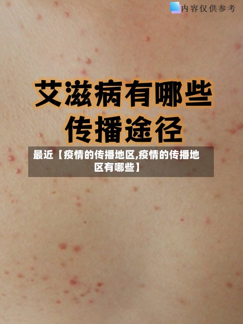 最近【疫情的传播地区,疫情的传播地区有哪些】-第3张图片