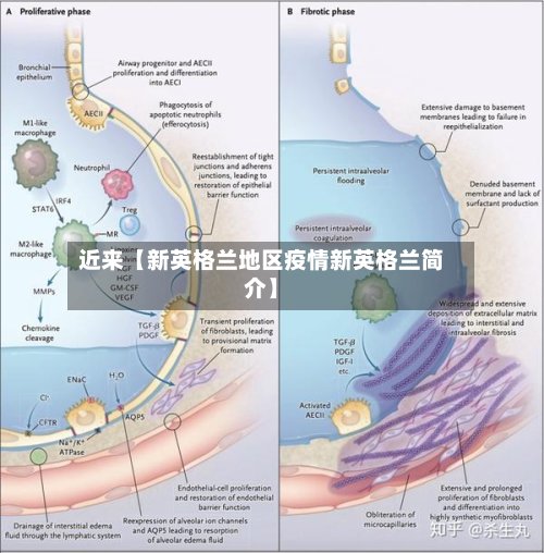 近来【新英格兰地区疫情新英格兰简介】-第2张图片