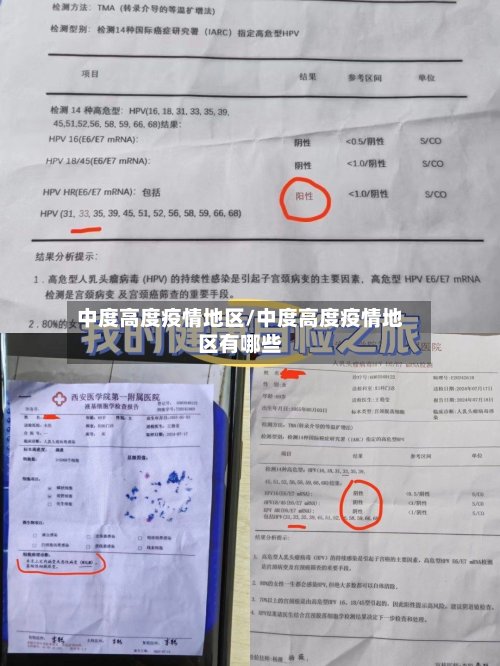 中度高度疫情地区/中度高度疫情地区有哪些-第2张图片