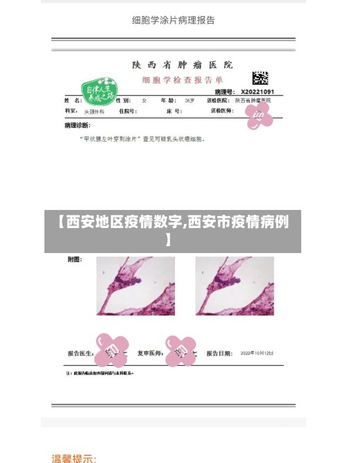 【西安地区疫情数字,西安市疫情病例】