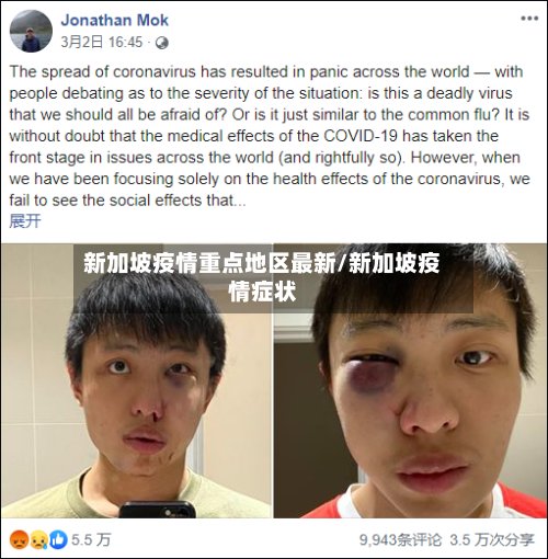 新加坡疫情重点地区最新/新加坡疫情症状