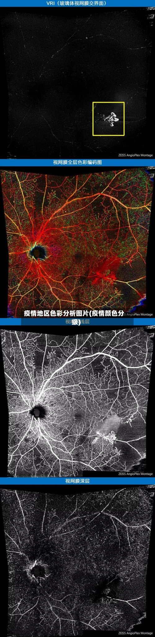 疫情地区色彩分析图片(疫情颜色分级)-第2张图片