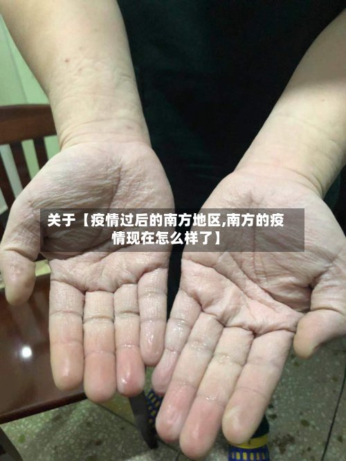 关于【疫情过后的南方地区,南方的疫情现在怎么样了】-第2张图片
