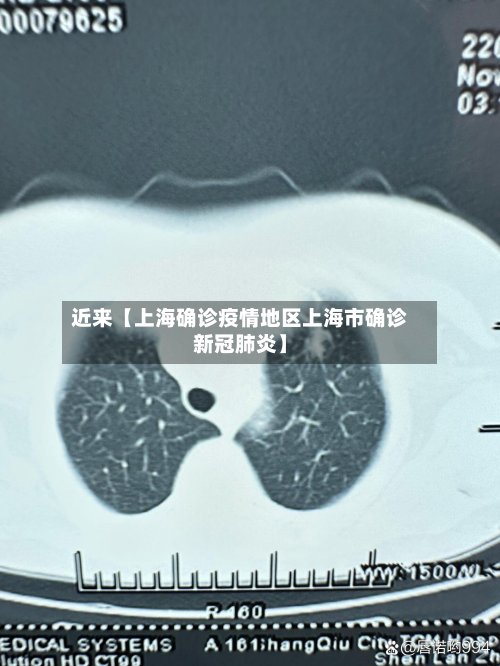近来【上海确诊疫情地区上海市确诊新冠肺炎】-第3张图片