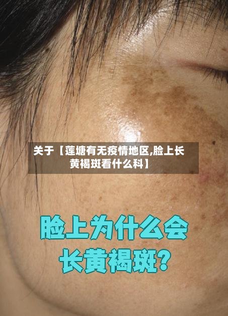 关于【莲塘有无疫情地区,脸上长黄褐斑看什么科】-第2张图片