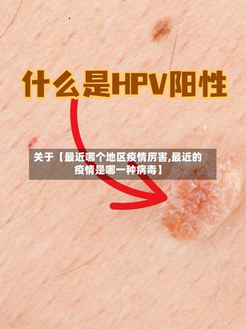 关于【最近哪个地区疫情厉害,最近的疫情是哪一种病毒】