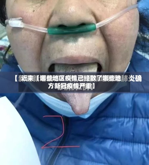 近来【哪些地区疫情已经散了哪些地方新冠疫情严重】-第2张图片