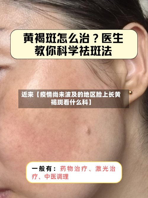 近来【疫情尚未波及的地区脸上长黄褐斑看什么科】-第2张图片
