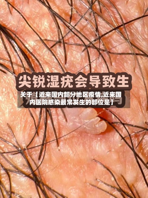 关于【近来国内部分地区疫情,近来国内医院感染最常发生的部位是】-第2张图片