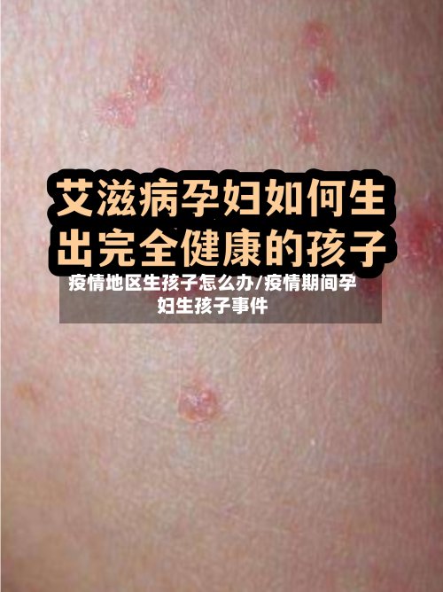 疫情地区生孩子怎么办/疫情期间孕妇生孩子事件