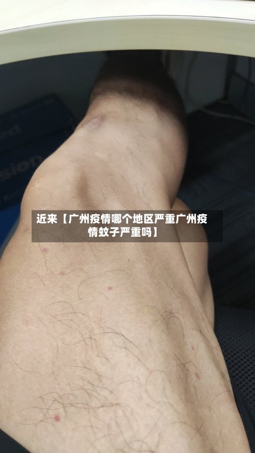 近来【广州疫情哪个地区严重广州疫情蚊子严重吗】