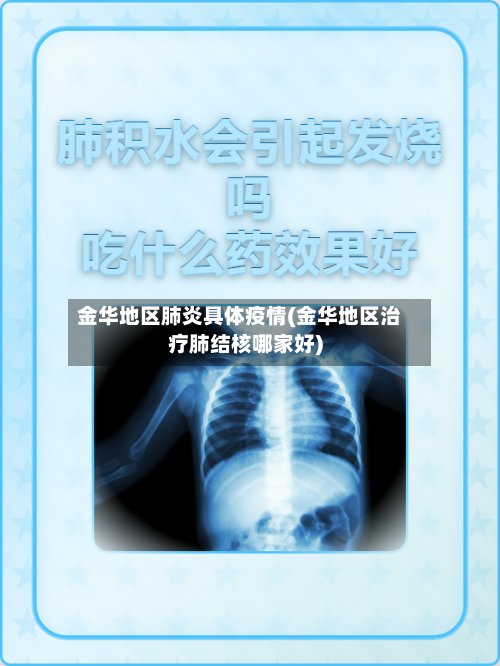 金华地区肺炎具体疫情(金华地区治疗肺结核哪家好)