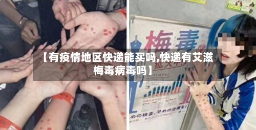 【有疫情地区快递能买吗,快递有艾滋梅毒病毒吗】-第2张图片